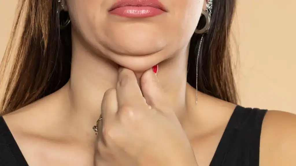 An image of a woman with double chin, sad, worried : Non Surgical Double Chin Removal Treatment in Dunfermline, UK