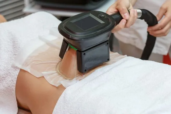 Image of person having fat freezing treatment to help weight gain Dunfermline