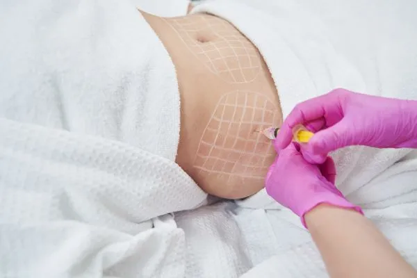 image of fat dissolving injections on love handles to help combat weight gain Dunfermline