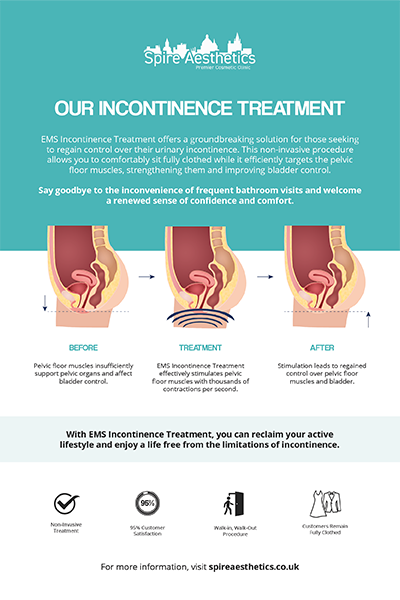 image to show how EMS treatment works for female urinary incontinence Dunfermline