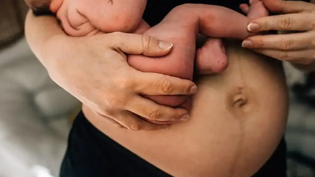 Why Is My Stomach Still Big After Pregnancy Dunfermline?